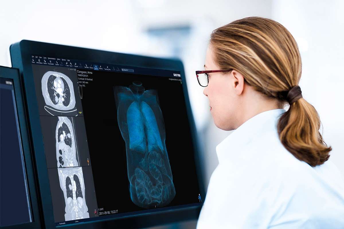 Kent NHS trusts to modernise patient diagnostics across the region with Sectra