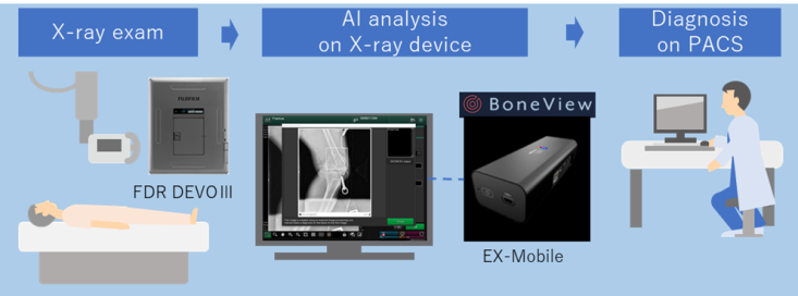 Boneview flow chart